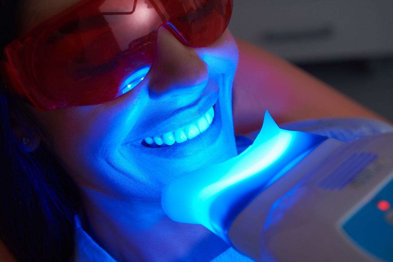 Wybielanie zębów – jak przebiega ten zabieg?